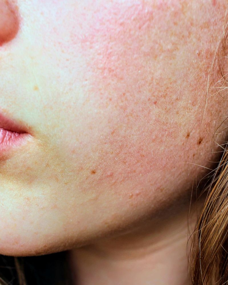Skin before treatment
