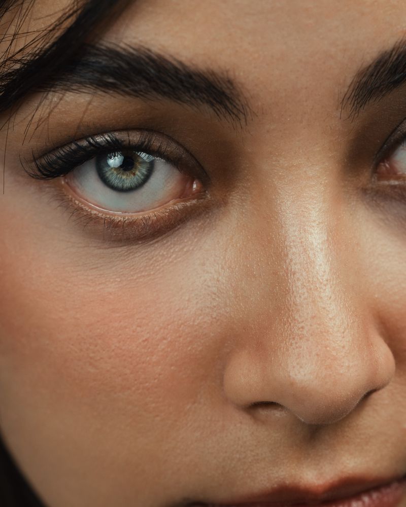Skin after treatment