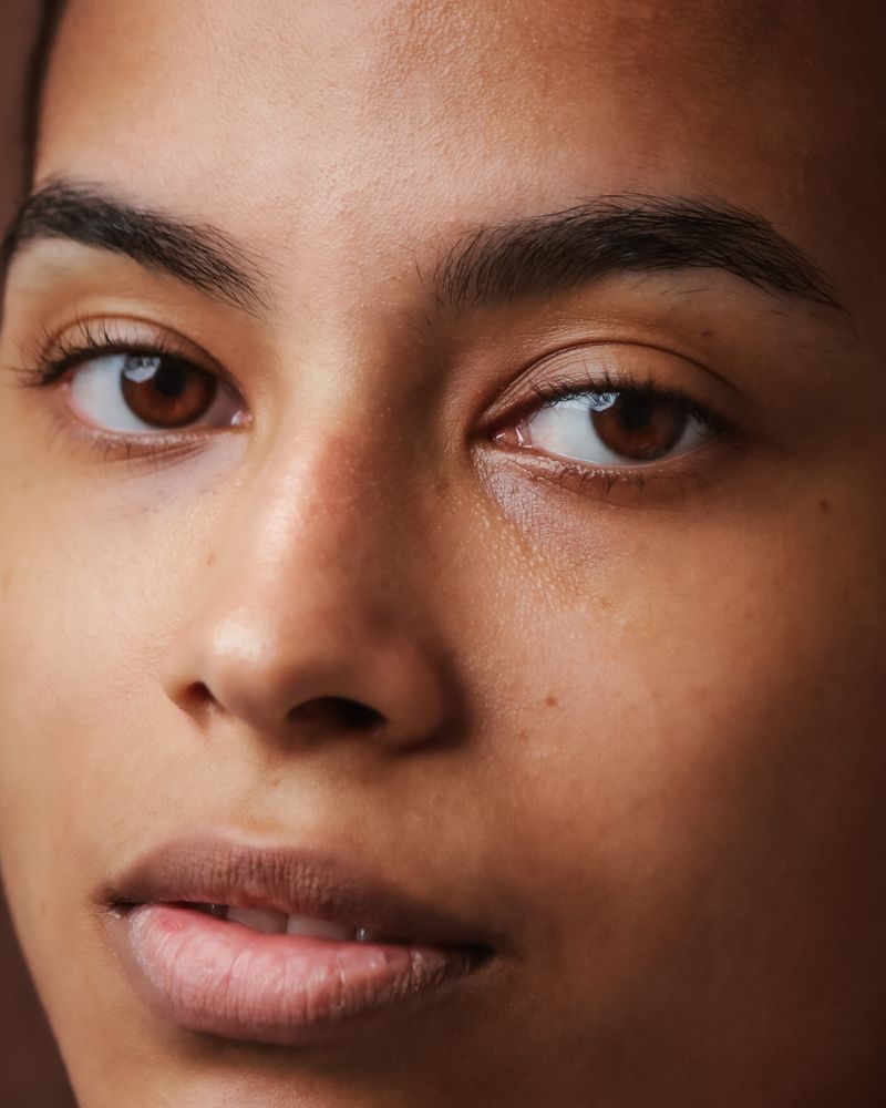 Skin before treatment