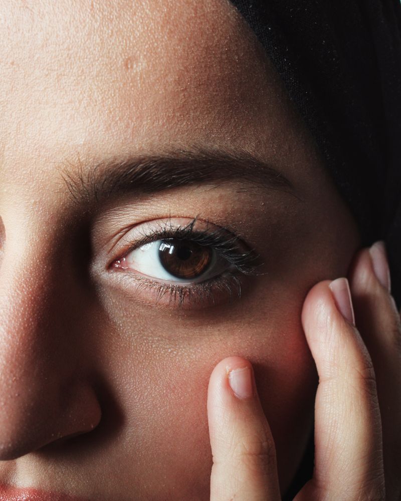 Skin before treatment